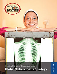 A young woman standing behind a chest x-ray