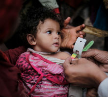 In Yemen, more than two million children are malnourished, including this young girl who is being treated by our partner UNICEF. Medical staff take her arm measurements to track her progress. Photo credit: © UNICEF/Almang