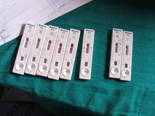 Rapid diagnostic tests (RDTs) in an Angolan clinic. Credit Angus Spiers USAID