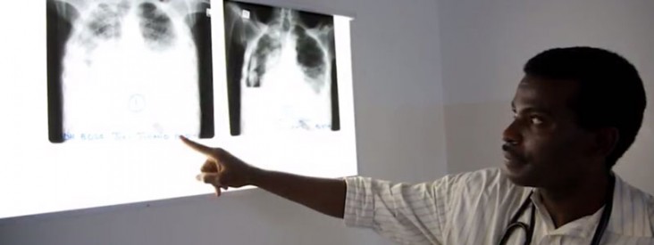 A doctor points to an x-ray of a person's chest.