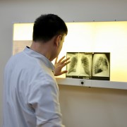 Dr. Amanzhan Abubakirov, a TB specialist, reviews a chest X-ray